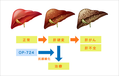 肝硬変に対する開発パイプライン